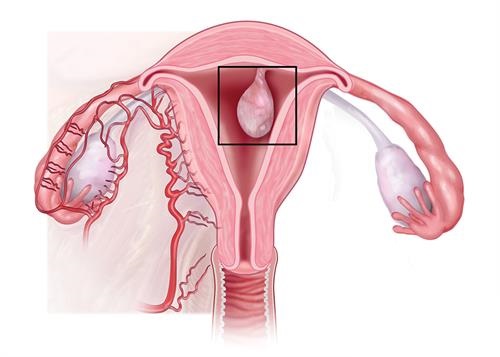 Uterus & Fertility Cleanse